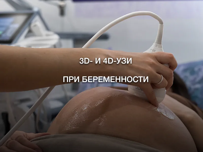 3D- и 4D-УЗИ при беременности